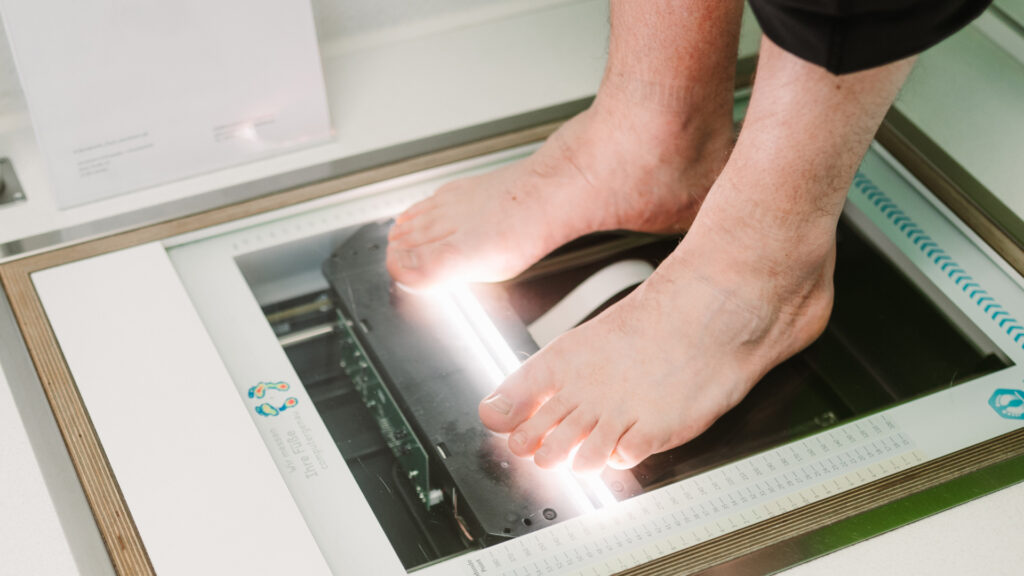 Hallux valgus (Ballenzeh)